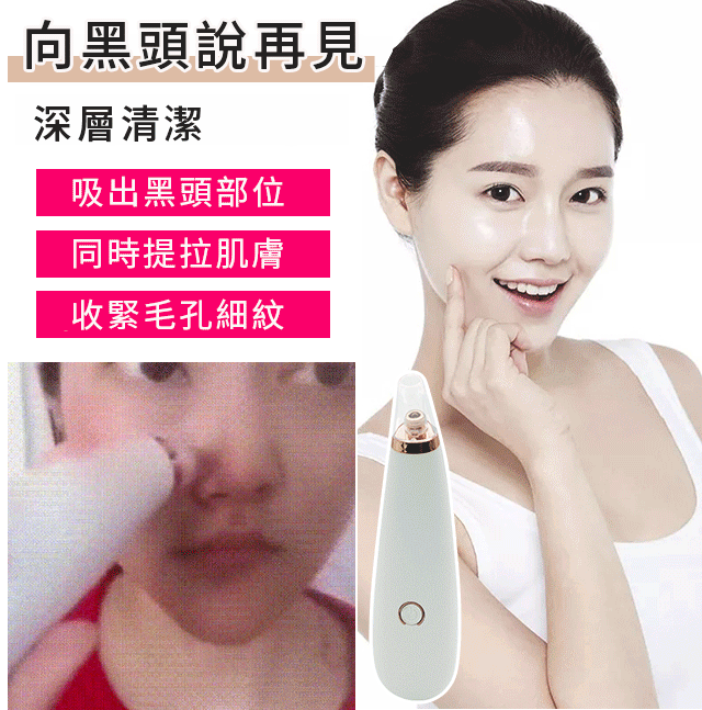 【家用吸黑頭神器】黑頭、粉刺、痘痘都不見了,深層清潔,收縮毛孔細紋!