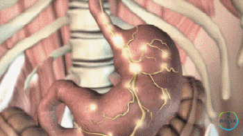 1781253267813342.gif